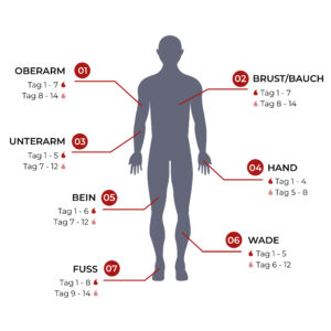 Blumenorca – Bild 4