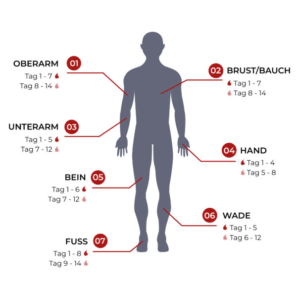 Blumenorca – Bild 4